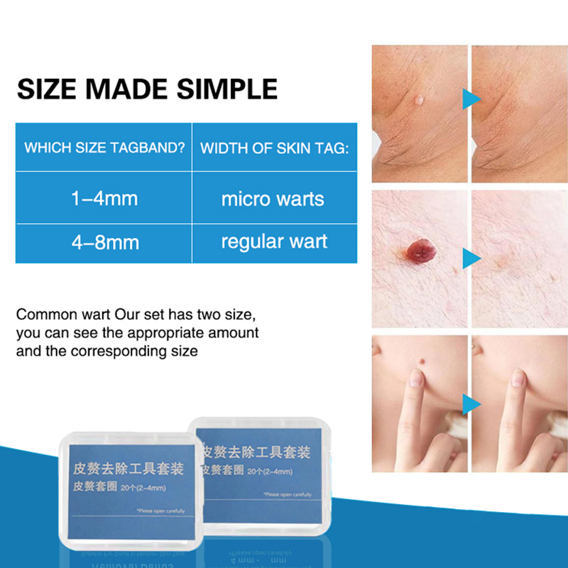 20pcs/Box Flesh Nevus Removal  - Power Tools Organizer review and price